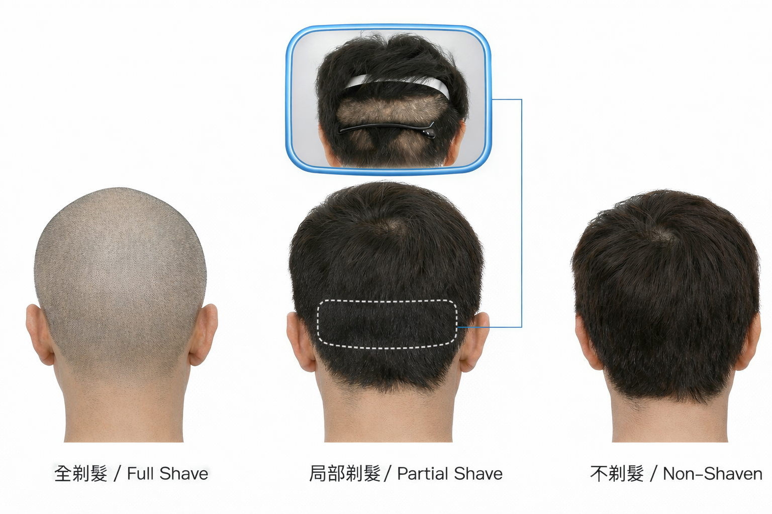 圖：三種剃髮方式的對比示意圖