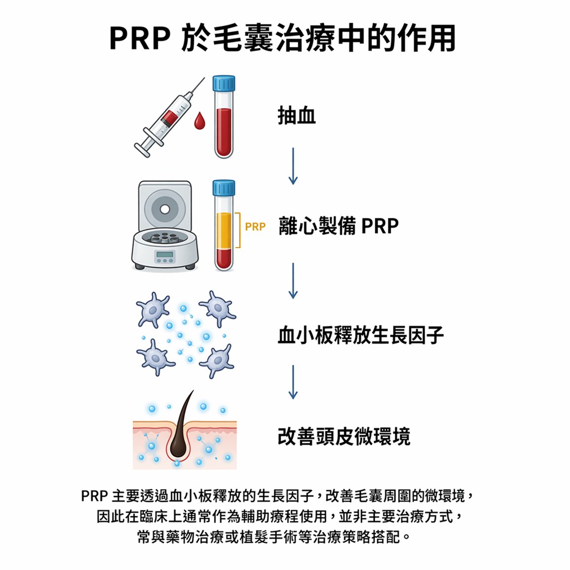 圖：PRP 於毛囊治療中的作用