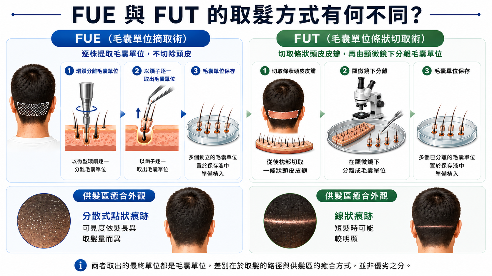 圖：FUE 與 FUT 取髮方式比較圖