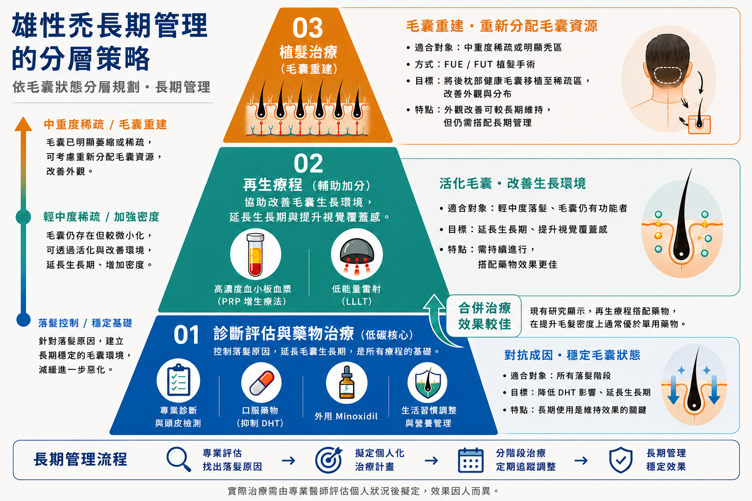 圖：雄性禿長期管理的分層策略