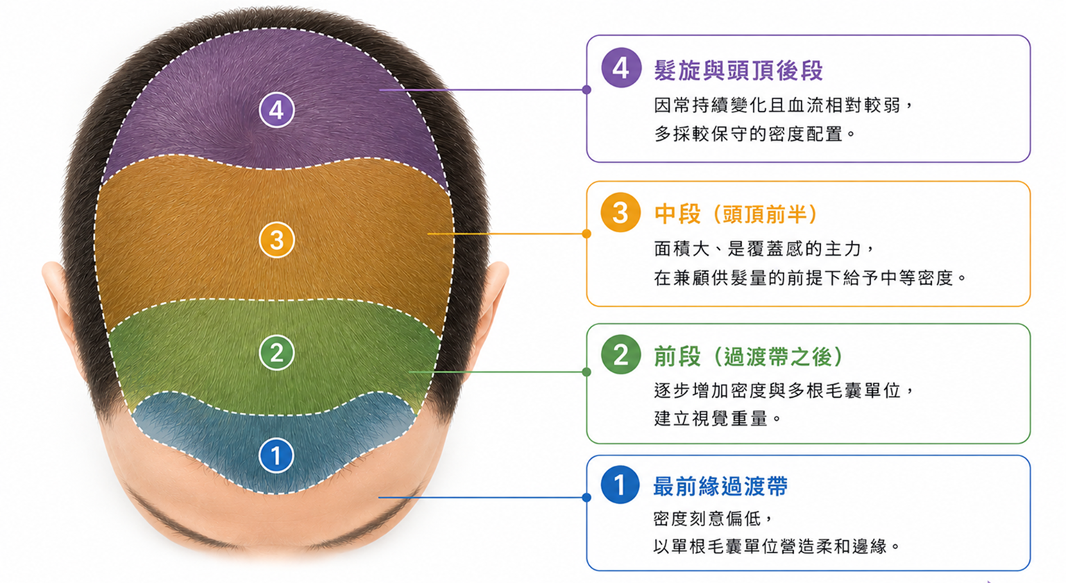 圖：頭皮分區密度配置示意圖