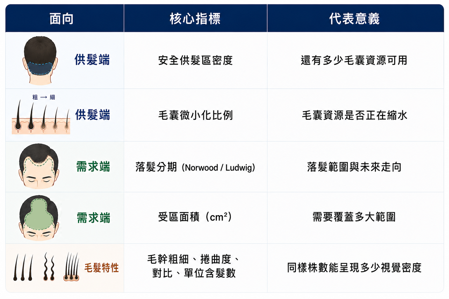 圖：植髮規劃評估重點對照表