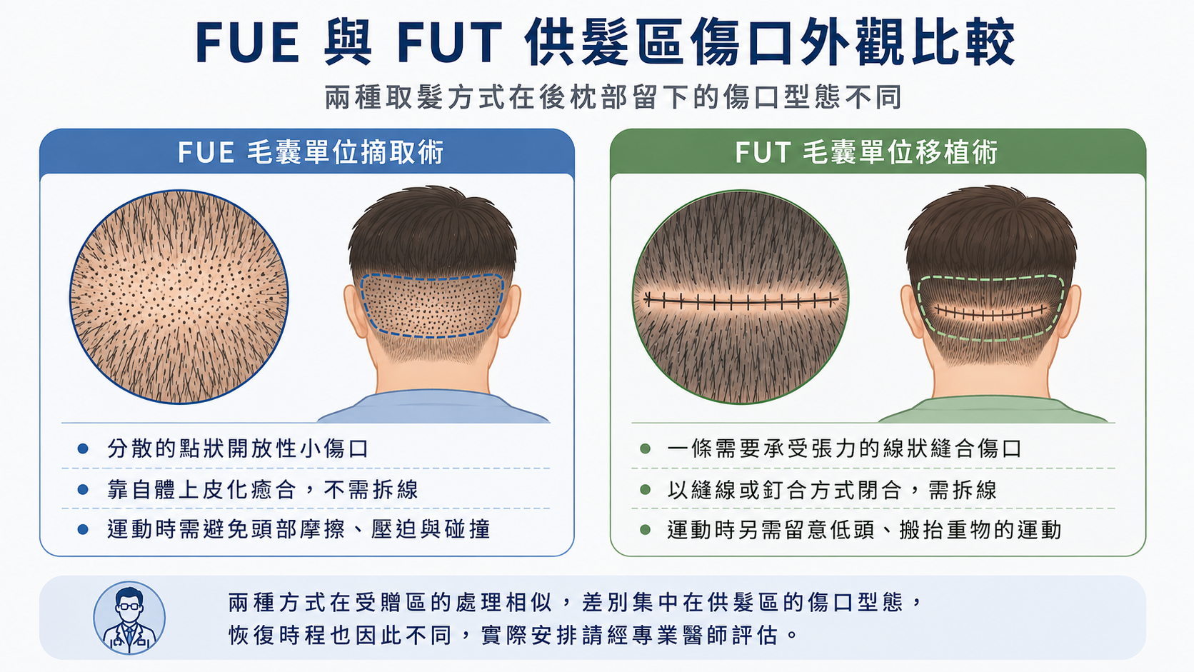 圖：FUE 與 FUT 供髮區傷口外觀比較