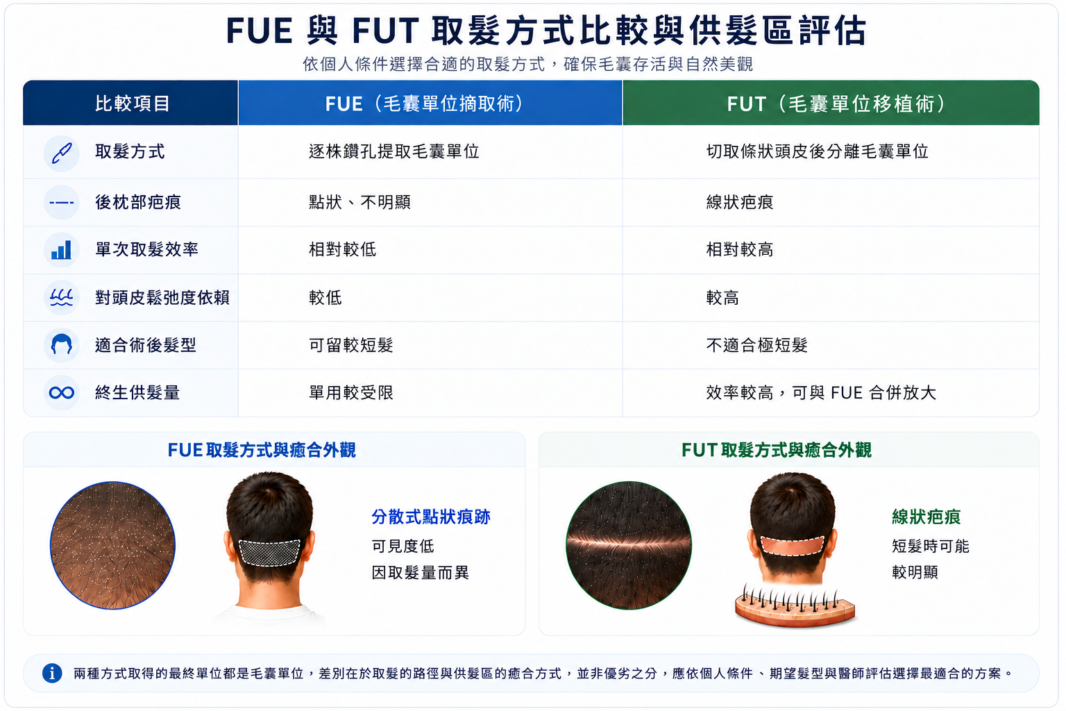 圖：FUE vs FUT供髮區比較示意圖